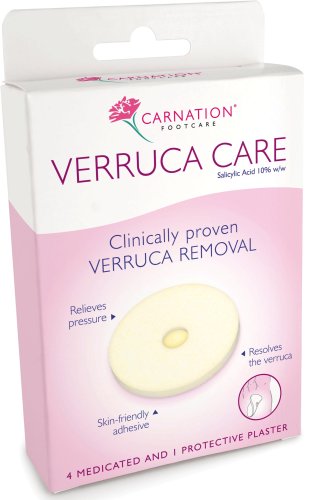 Carnation Verruca Treatment